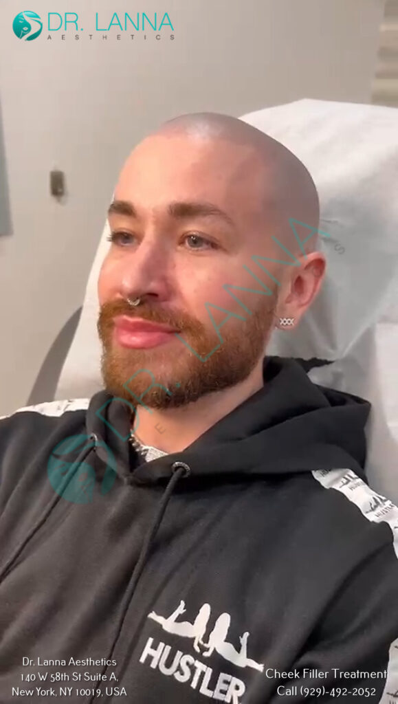 Cheek filler client relaxing in the treatment chair at Dr. Lanna Aesthetics, NYC