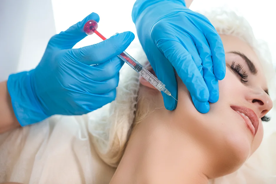 cheek filler treatment