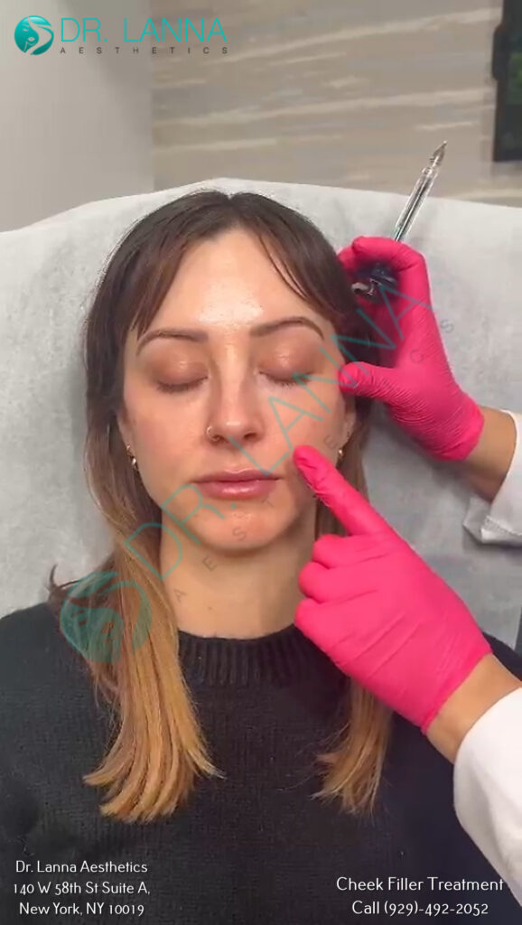 a woman getting cheek filler treatment