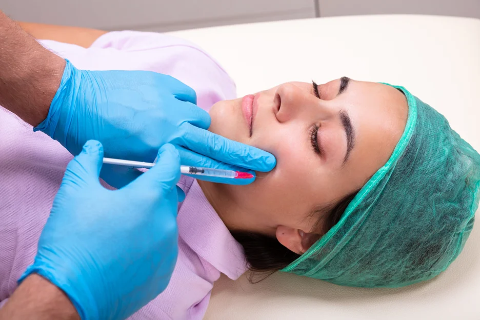 a woman received cheek filler injections