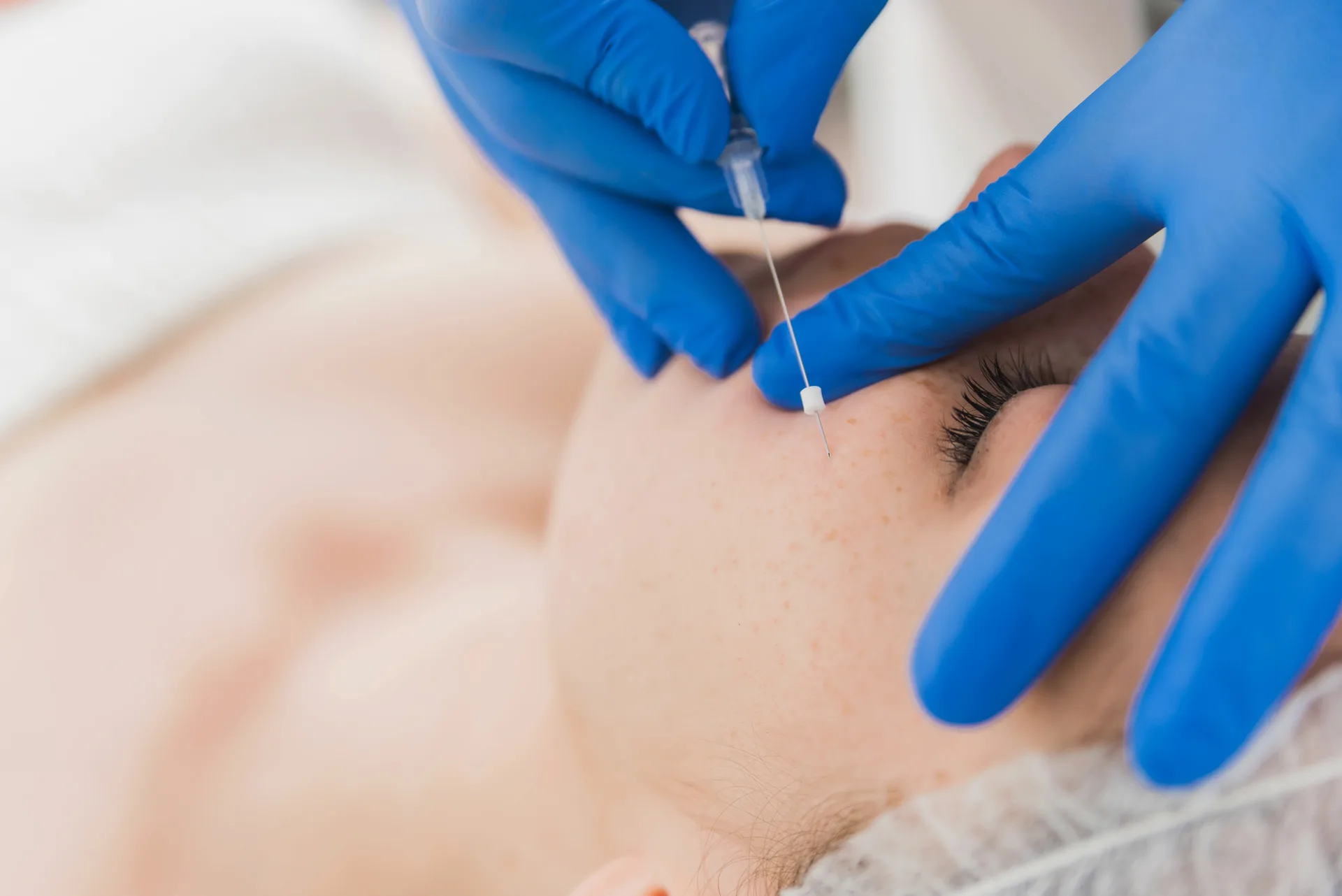 PDO Threads at Dr. Lanna Aesthetics