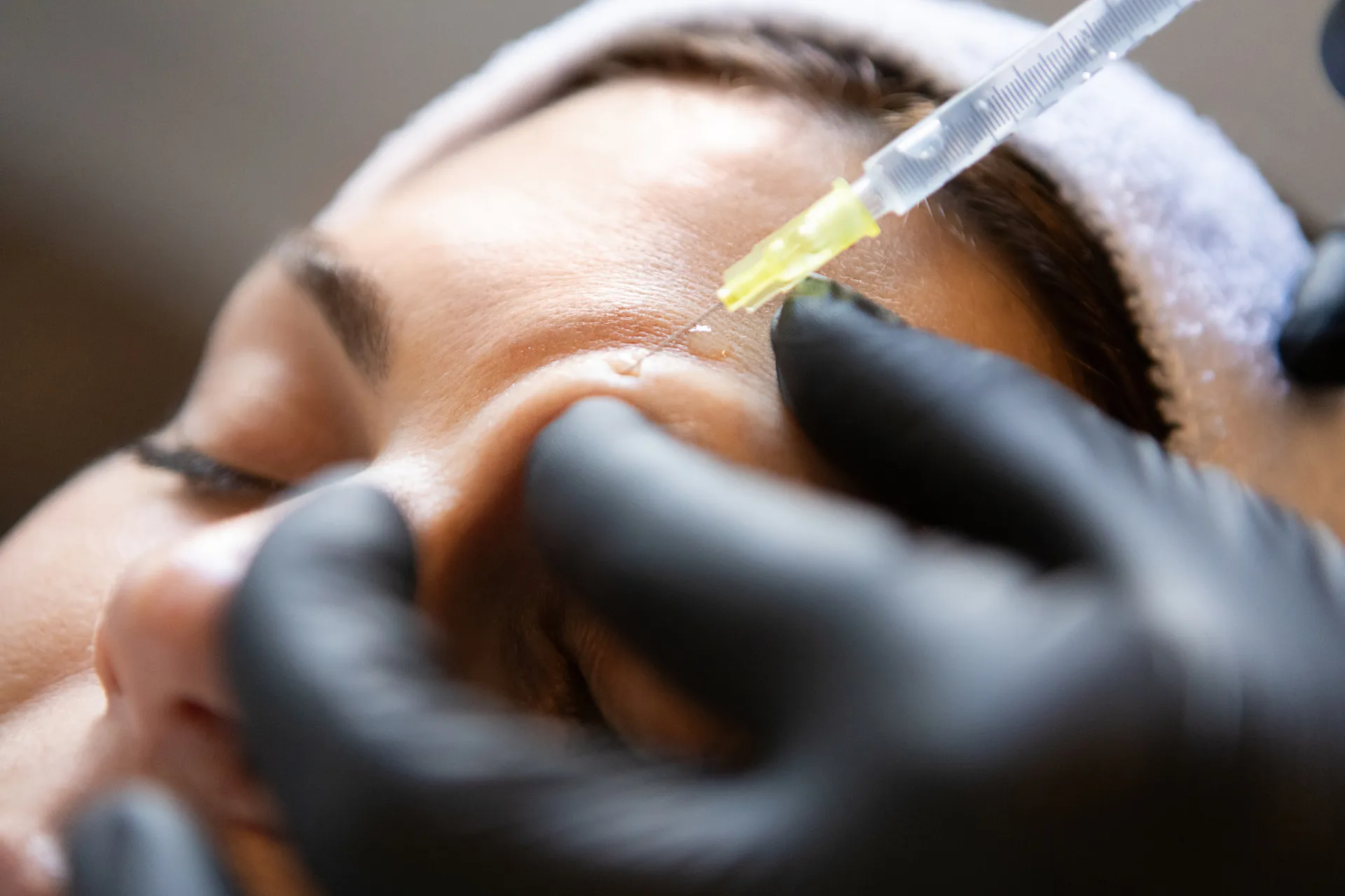 Neurotoxin treatment at Dr. Lanna Aesthetics