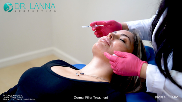 Filler treatment at Dr. Lanna Aesthetics