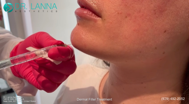 woman's chin filler treatment cost inside a clinic
