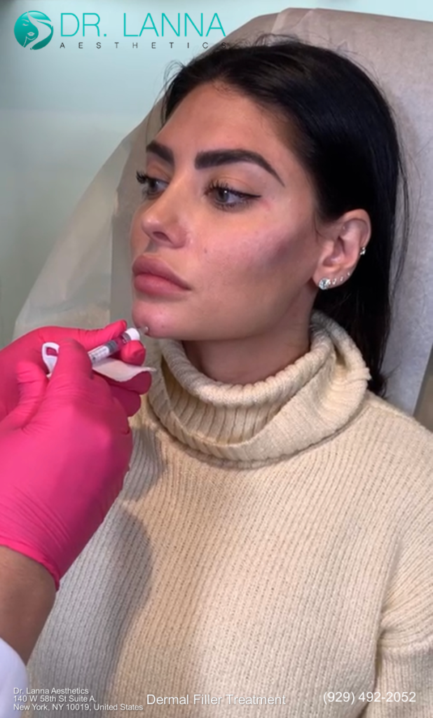 woman has chin filler injections