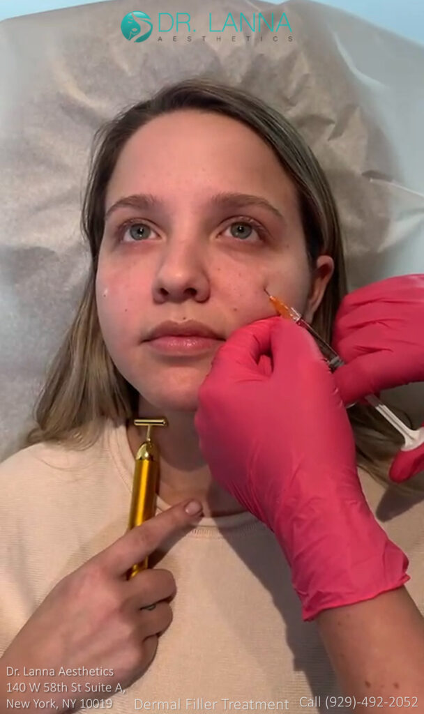 woman receives cheek filler treatment inside the clinic