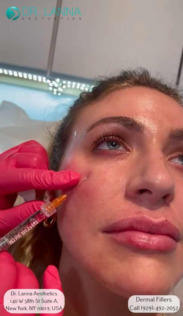 a woman undergoes filler treatment in her eyes