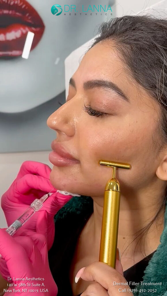 a woman received dermal filler injections on her jawline at Dr. Lanna's clinic