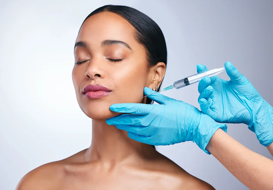 a woman got dermal filler injections on her jawline