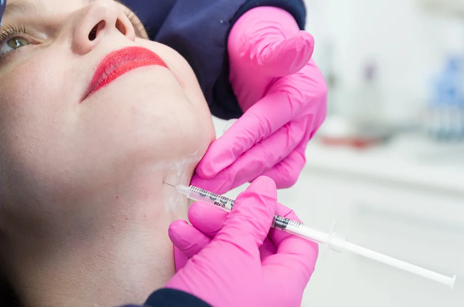 a woman had cheek filler injection in her jowls