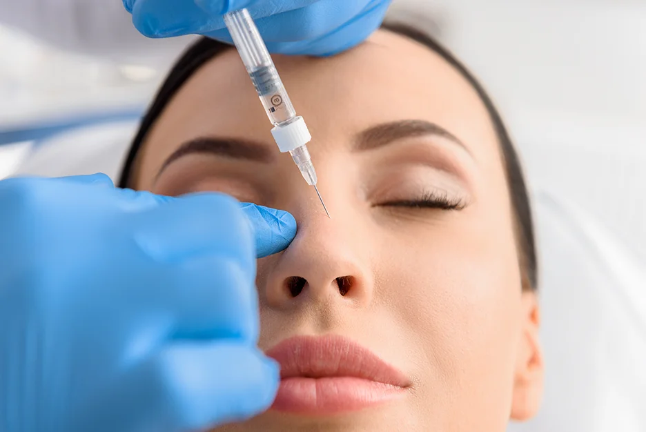 a woman had filler injection on her nose